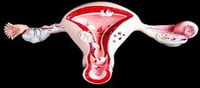 Reasons behind the failure of the Uterus...